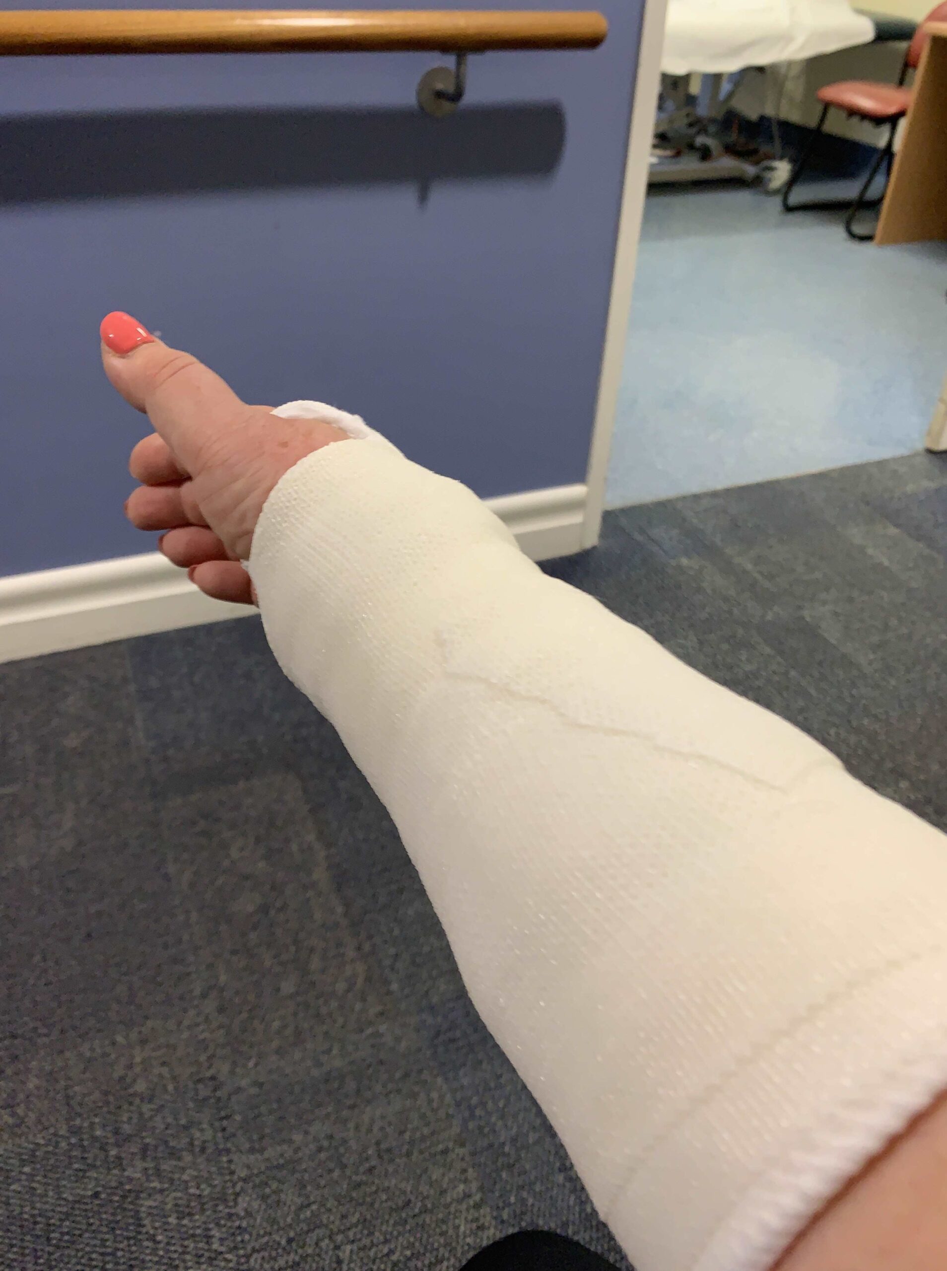 Casts On and Off.... - Days Filled With Joy